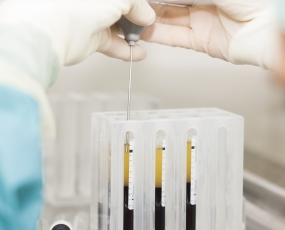 Unidad de Terapia Biológica Avanzada